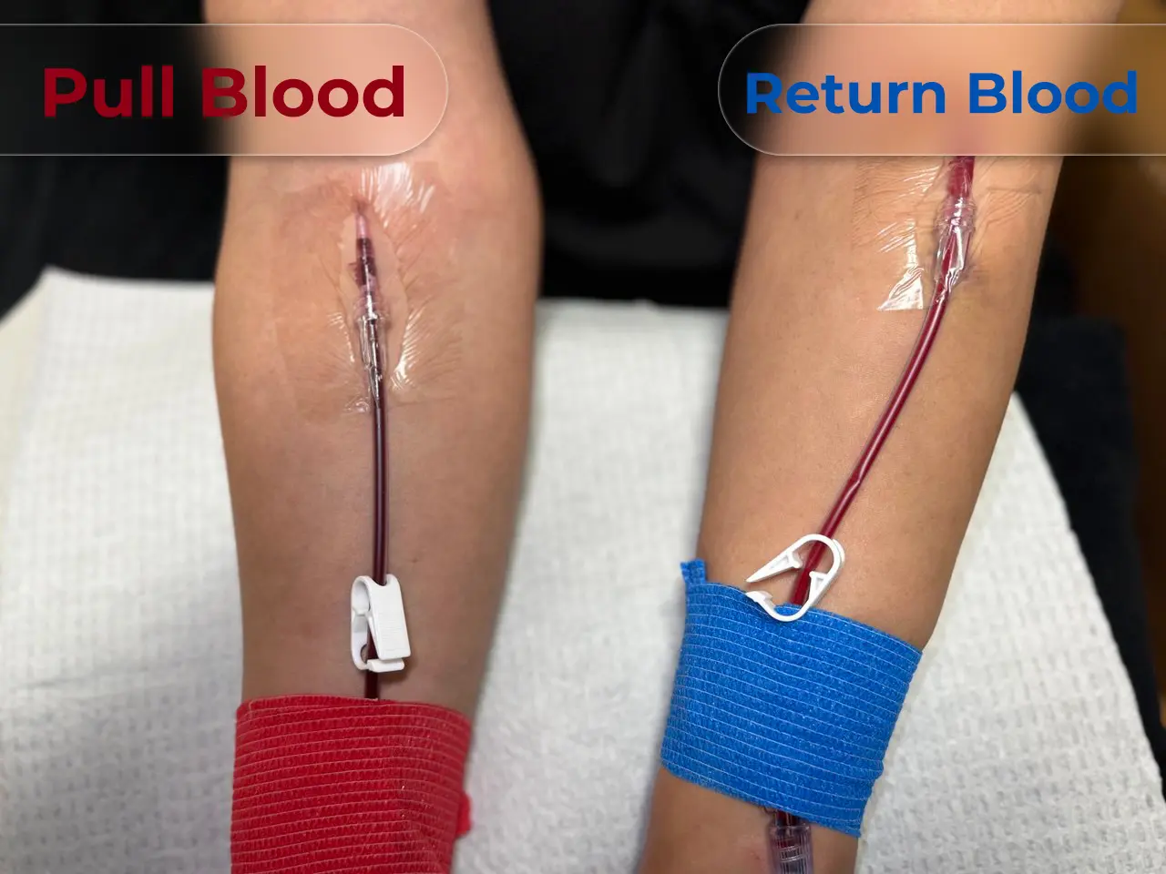 Pull Blood & Return Blood in Eboo Therapy in Houston - Revived Personalized Wellness for Advanced Eboo Therapy in Houston